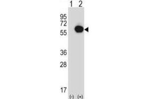 Western Blotting (WB) image for anti-Ran GTPase Activating Protein 1 (RANGAP1) antibody (ABIN2997532)