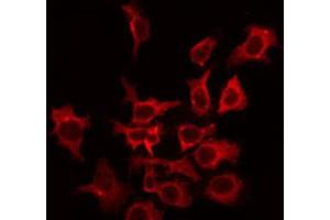Immunofluorescence (fixed cells) (IF/ICC) image for anti-Potassium Voltage-Gated Channel, Shaw-Related Subfamily, Member 2 (KCNC2) (C-Term) antibody (ABIN6262739)