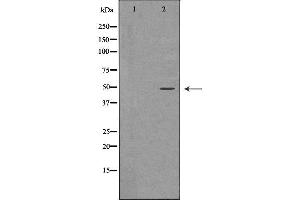 Western blot analysis of Hela whole cell lysates, using PSMC4 Antibody. (PSMC4 Antikörper  (C-Term))