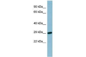 WB Suggested Anti-RBP4 Antibody Titration:  0. (RBP4 Antikörper  (N-Term))