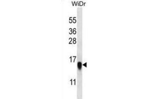 Western Blotting (WB) image for anti-Ribosomal Protein L35 (RPL35) antibody (ABIN2997048) (RPL35 Antikörper)