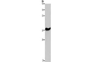 Gel: 8 % SDS-PAGE, Lysate: 40 μg, Lane: Mouse brain tissue, Primary antibody: ABIN7190859(GPR78 Antibody) at dilution 1/200, Secondary antibody: Goat anti rabbit IgG at 1/8000 dilution, Exposure time: 10 minutes