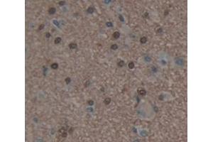 IHC-P analysis of Human Tissue, with DAB staining. (HDAC9 Antikörper  (AA 23-343))