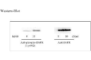 Image no. 3 for Epidermal Growth Factor Receptor (EGFR) ELISA Kit (ABIN625238) (EGFR ELISA Kit)