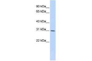 WDR33 antibody used at 1 ug/ml to detect target protein. (WDR33 Antikörper  (Middle Region))