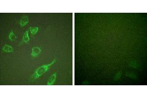 PMA + -Immunofluorescence analysis of HeLa cells, treated with PMA (125ng/ml, 30mins), using 14-3-3 ζ (phospho-Ser58) antibody. (14-3-3 zeta Antikörper  (pSer58))