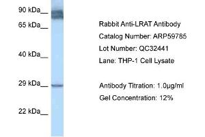 Western Blotting (WB) image for anti-Lecithin Retinol Acyltransferase (Phosphatidylcholine--Retinol O-Acyltransferase) (LRAT) (N-Term) antibody (ABIN2788210) (LRAT Antikörper  (N-Term))