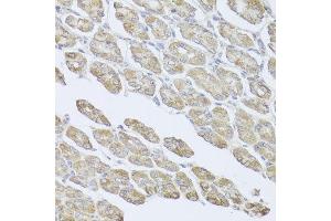 Immunohistochemistry of paraffin-embedded mouse stomach using MSMB antibody at dilution of 1:100 (x40 lens).