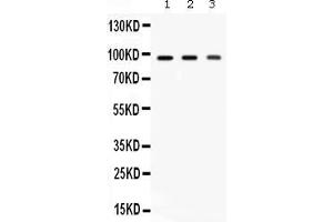 Western blot analysis of Ago2/eIF2C2 expression in rat brain extract ( Lane 1), mouse brain extract ( Lane 2) and HELA whole cell lysates ( Lane 3). (AGO2 Antikörper  (N-Term))