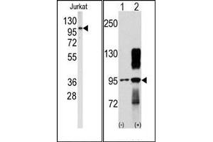 Image no. 1 for anti-Discoidin Domain Receptor tyrosine Kinase 2 (DDR2) antibody (ABIN359957) (DDR2 Antikörper)