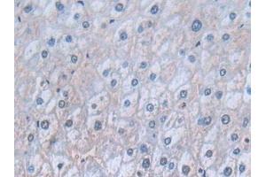 Detection of CD74 in Human Liver Tissue using Polyclonal Antibody to Cluster Of Differentiation 74 (CD74) (CD74 Antikörper  (AA 78-222))