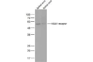 Lane 1: Mouse Spinal cord lysates Lane 2: Rat Spinal cord lysates probed with KiSS1 receptor Polyclonal Antibody, Unconjugated  at 1:2000 dilution and 4˚C overnight incubation.