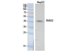 Western Blotting (WB) image for anti-Radical S-Adenosyl Methionine Domain Containing 2 (RSAD2) (Internal Region) antibody (ABIN3178550) (RSAD2 Antikörper  (Internal Region))