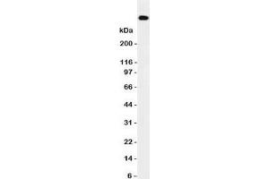 Western blot testing of DNA PKcs antibody and HeLa cell lysate. (PRKDC Antikörper  (N-Term))