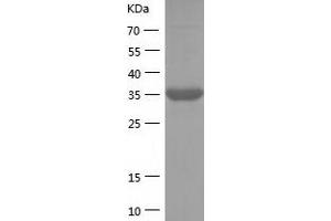 Western Blotting (WB) image for Fission 1 (FIS1) (AA 1-122) protein (His-IF2DI Tag) (ABIN7122969)