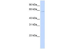 WB Suggested Anti-ZNF579 Antibody Titration:  0. (ZNF579 Antikörper  (Middle Region))