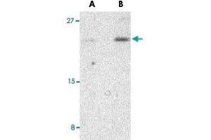 Western blot analysis of BIK in Jurkat cell lysate with BIK polyclonal antibody  at (A) 1 and (B) 2 ug/mL .