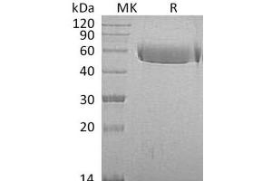 Western Blotting (WB) image for alpha-2-HS-Glycoprotein (AHSG) protein (His tag) (ABIN7320990)