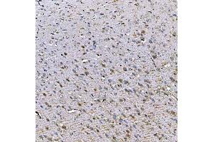 IHC analysis of TOM1L1 using anti-TOM1L1 antibody (ABIN7602631). (TOM1L1 Antikörper  (AA 9-448))