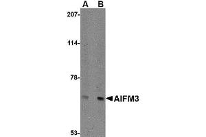 Western blot analysis of NIPSNAP in human brain tissue lysate with AP30032PU-N NIPSNAP antibody at (A) 0.