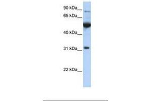 Image no. 1 for anti-Eukaryotic Translation Initiation Factor 2B, Subunit 1 Alpha, 26kDa (EIF2B1) (C-Term) antibody (ABIN6738798) (EIF2B1 Antikörper  (C-Term))
