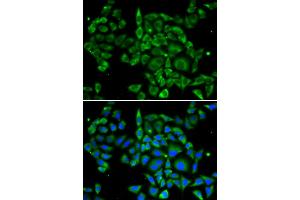 Immunofluorescence analysis of U2OS cells using PRKCA antibody. (PKC alpha Antikörper)