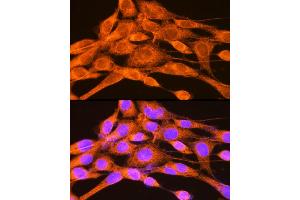 Immunofluorescence (IF) image for anti-phosphorylase Kinase, gamma 2 (Testis) (PHKG2) (AA 237-406) antibody (ABIN6145563)