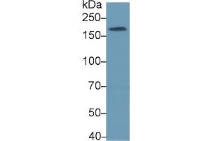 Detection of TOPBP1 in Human Serum using Polyclonal Antibody to Topoisomerase II Binding Protein 1 (TOPBP1)