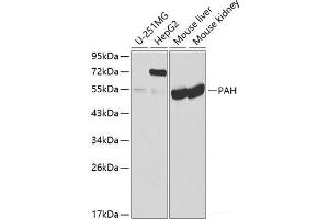 Western blot analysis of extracts of various cell lines using PAH Polyclonal Antibody at dilution of 1:1000. (Phenylalanine Hydroxylase Antikörper)