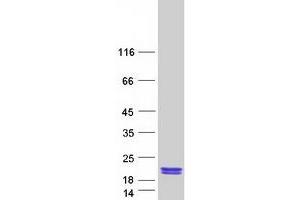 Validation with Western Blot (PTRHD1 Protein (Myc-DYKDDDDK Tag))