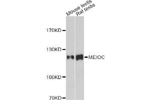 Western blot analysis of extracts of various cell lines, using MEIOC antibody. (Gm1564 Antikörper)