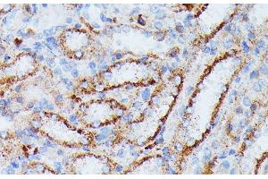 Immunohistochemistry of paraffin-embedded Rat kidney using IDH3A Polyclonal Antibody at dilution of 1:100 (40x lens). (IDH3A Antikörper)