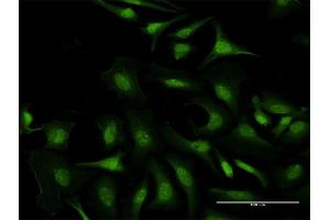 Immunofluorescence of purified MaxPab antibody to C5orf51 on HeLa cell. (C5orf51 Antikörper  (AA 1-294))