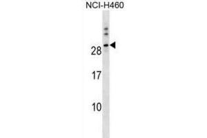 Western Blotting (WB) image for anti-Tweety Homolog 1 (TTYH1) antibody (ABIN3000109) (TTYH1 Antikörper)