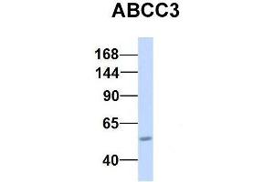 Host:  Rabbit  Target Name:  CHAD  Sample Type:  Human Adult Placenta  Antibody Dilution:  1. (ABCC3 Antikörper  (Middle Region))