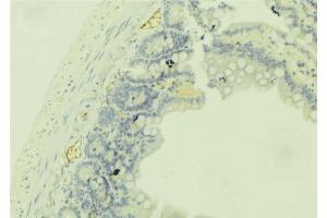 ABIN6279350 at 1/100 staining Mouse colon tissue by IHC-P. (DHRS9 Antikörper  (Internal Region))