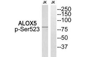 Western blot analysis of extracts from Jurkat cells, using ALOX5 (Phospho-Ser523) antibody. (ALOX5 Antikörper  (pSer523))