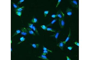 IF analysis of ANGPT2 using anti-ANGPT2 antibody (ABIN7601450).