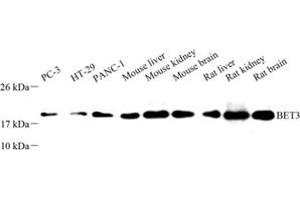 Western blot analysis of BET3 (ABIN7075949) at dilution of 1: 500