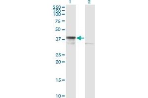 Western Blot analysis of DNAJB6 expression in transfected 293T cell line by DNAJB6 monoclonal antibody (M02), clone 2D12-B9. (DNAJB6 Antikörper  (AA 1-241))