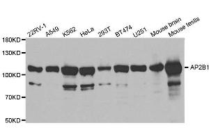 Western blot analysis of extracts of various cell lines, using AP2B1 antibody. (AP2B1 Antikörper  (AA 752-951))
