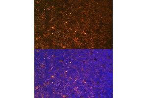 Immunofluorescence analysis of Rat thymus using CTGF antibody (ABIN6127716, ABIN6139187, ABIN6139190 and ABIN6215053) at dilution of 1:100. (CTGF Antikörper  (AA 27-349))