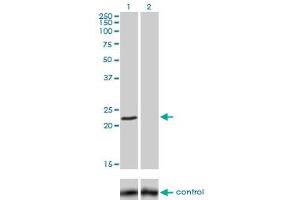 Western blot analysis of FXN over-expressed 293 cell line, cotransfected with FXN Validated Chimera RNAi (Lane 2) or non-transfected control (Lane 1).