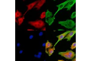 ABIN6264582 and ABIN6279743 staining HepG2 cells by IF/ICC. (RAB40C Antikörper  (C-Term))
