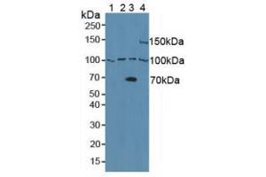 Western blot analysis of (1) Human Raji Cells, (2) Human Raw2647 Cells, (3) Human 293T Cells and (4) Mouse Pancreas Tissue. (ADAM8 Antikörper  (AA 145-493))