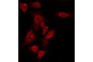 ABIN6275957 staining HuvEc by IF/ICC. (GPR150 Antikörper  (N-Term))