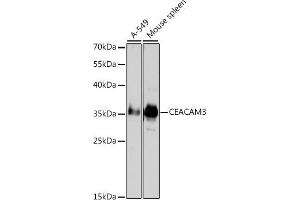 Western blot analysis of extracts of various cell lines, using CD66d/CE antibody (ABIN3016297, ABIN3016298, ABIN3016299 and ABIN6219699) at 1:1000 dilution.