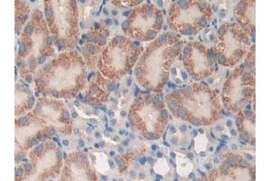 Immunohistochemistry (IHC) image for anti-Protein tyrosine Phosphatase, Receptor Type, J (PTPRJ) (AA 567-842) antibody (ABIN7441778)