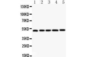 Anti- NR1H3 antibody,  Western blotting All lanes: Anti NR1H3 () at 0.