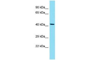 Western Blotting (WB) image for anti-Suppressor of Defective Silencing 3 Homolog (SUDS3) (N-Term) antibody (ABIN2788991) (SDS3 Antikörper  (N-Term))